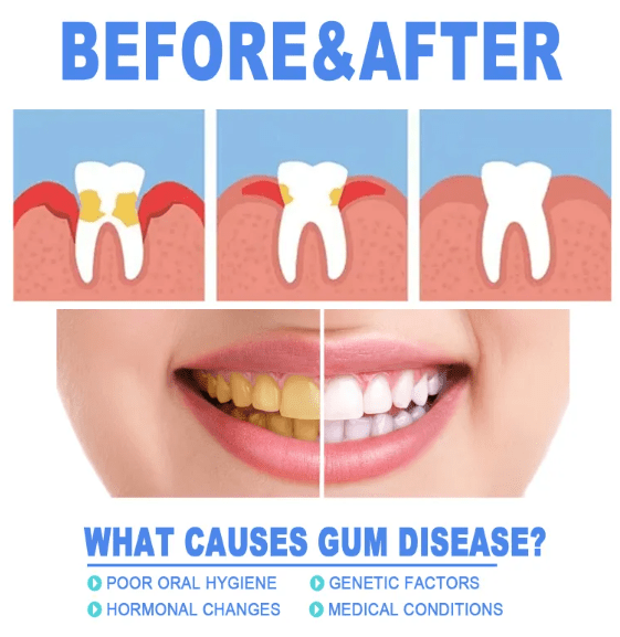 Teeth Repair Gel - H3NRY’S WORLD