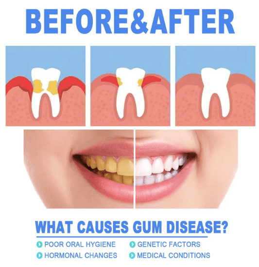 Teeth Repair Gel - H3NRY’S WORLD
