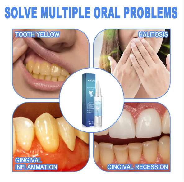 Teeth Repair Gel - H3NRY’S WORLD