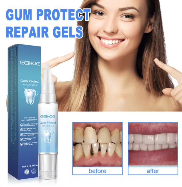 Teeth Repair Gel - H3NRY’S WORLD