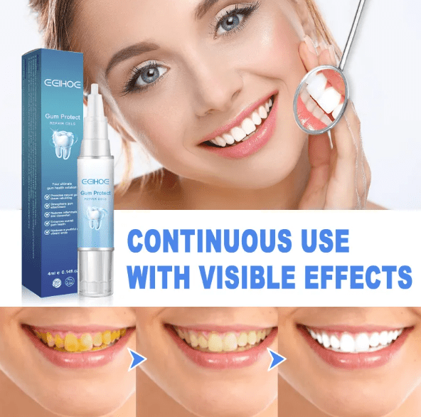 Teeth Repair Gel - H3NRY’S WORLD
